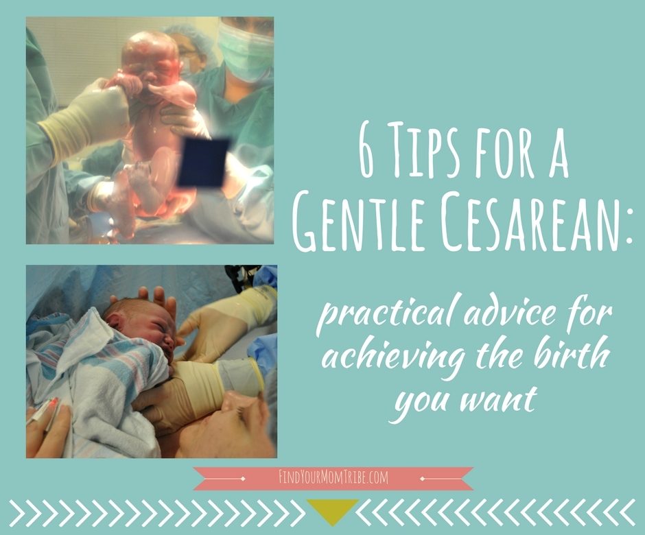 6 Tips for a Gentle Cesarean Practical Advice for Achieving the Birth