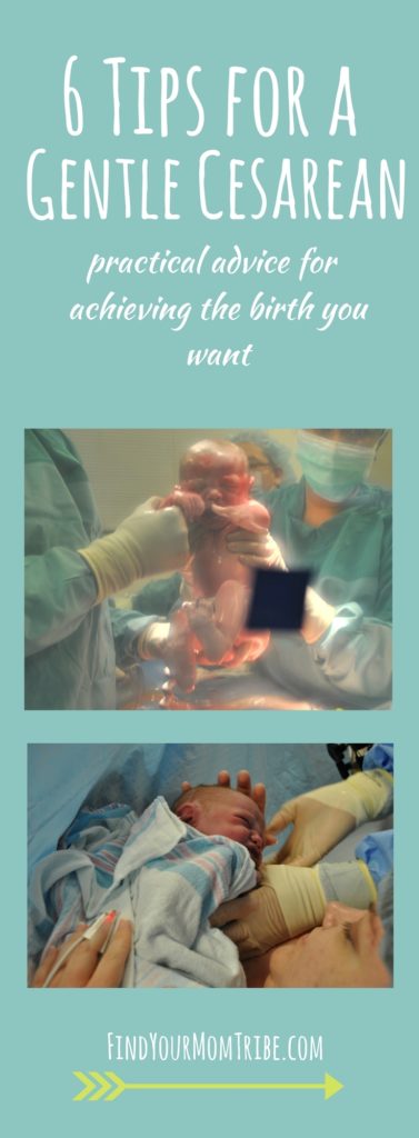 6 Tips for a Gentle Cesarean: Practical Advice for Achieving the Birth ...