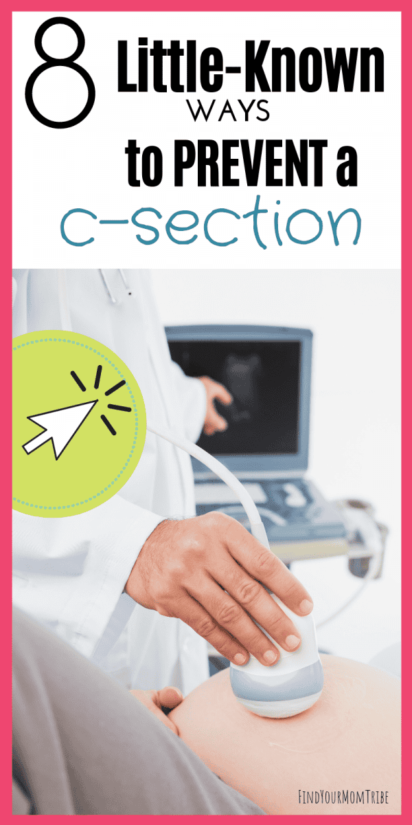 8 LittleKnown Ways to Avoid a CSection