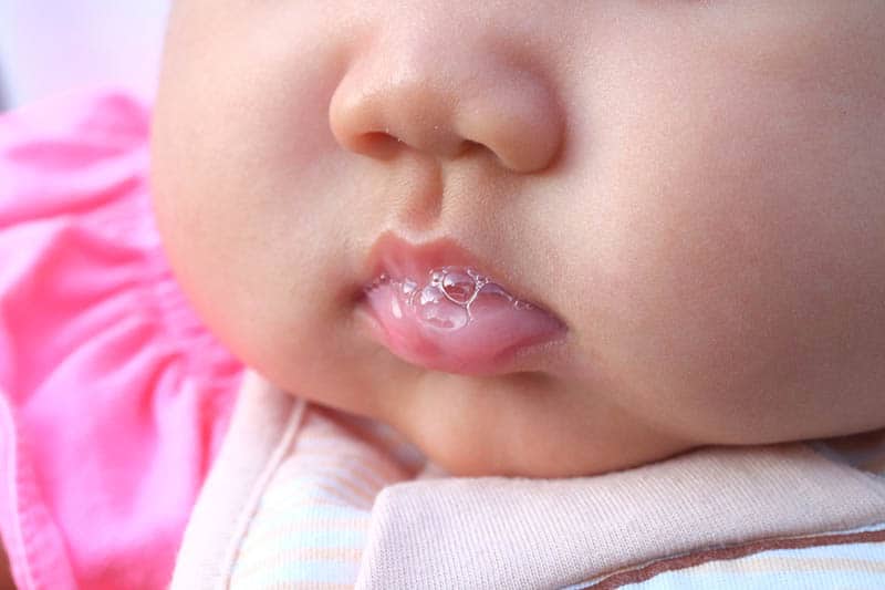 baby spit up clear with white chunks