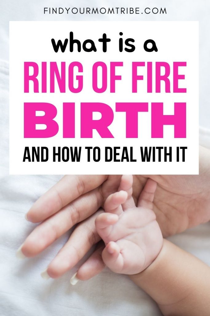 what-is-a-ring-of-fire-birth-and-how-to-deal-with-it