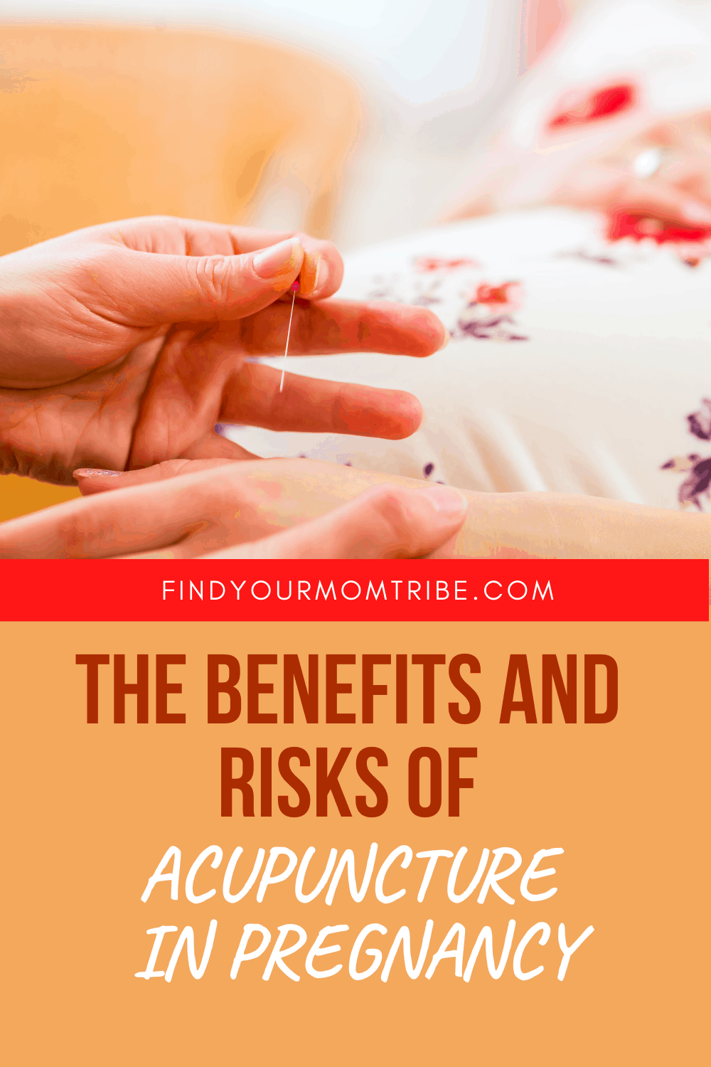 The Benefits And Risks Of Acupuncture In Pregnancy