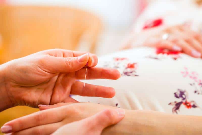 The Benefits And Risks Of Acupuncture In Pregnancy